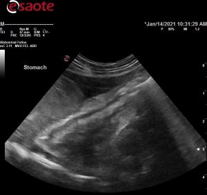 Thick submucosal layer in a cat