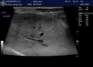 Pancreatic nodule or lymph node