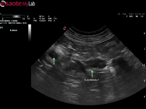 Adrenal gland images