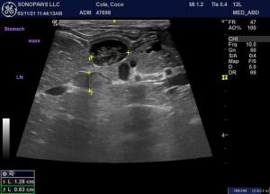 Stomach nodule in dorsal wall.