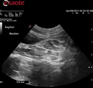 Suspect reactive medilal iliac lymph nodes in a cat