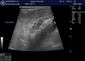 Mass in/near cranial pole of right adrenal?