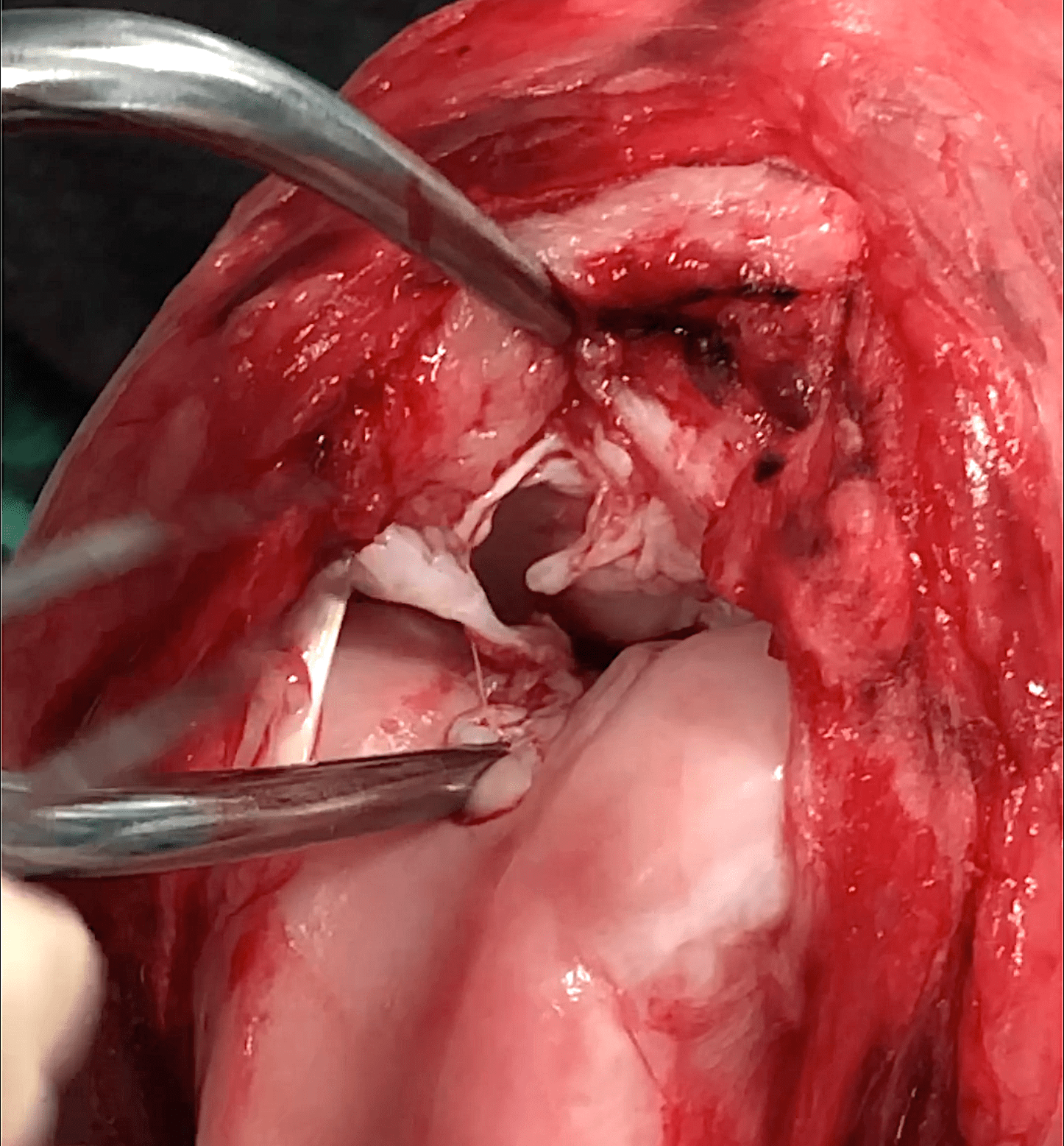 full_cranial_cruciate_rupture_still_screen_shot_2021-07-06_at_8