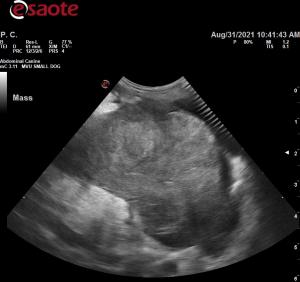 Mass in left abdomen