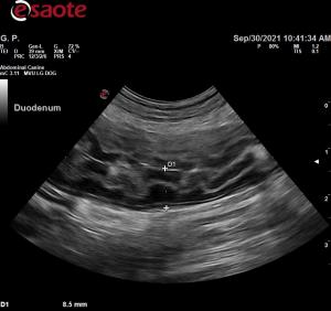 Abnormal small intestinal segment