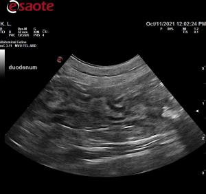 Acute vomiting and anorexia in a 4 yr old FS DSH