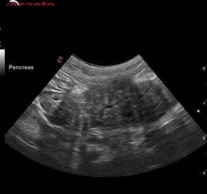 Abnormal pancreas in a 9 yr old DSH