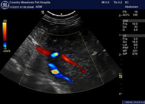 Mineralized mass of the spleen